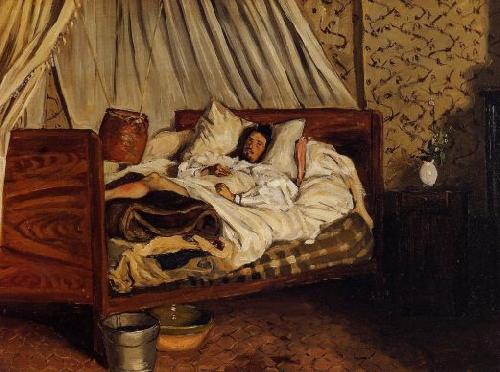 Frederic Bazille Monet after His Accident at the Inn of Chailly oil painting image